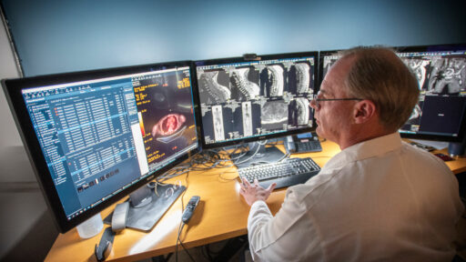 Multidisciplinary care is at the heart of the Myeloma Center’s treatment philosophy, and the radiology team plays a key role.