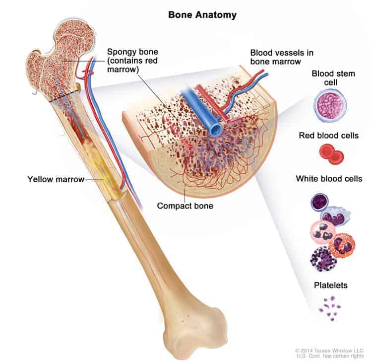 leukemia-acute-myeloid-adult-as-related-to-cancer-pictures